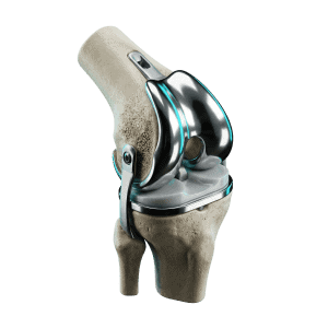 Metallic implants such as knee replacements are safe for InBody 970 scanning